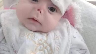 بالصور: لم يشفع لها برد الشتاء، الجرذان تنهش وجه طفلة تُركت في شوارع حلب